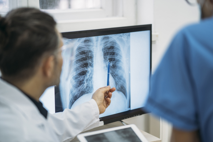 Close up of doctors analysing radiological chest x-ray film